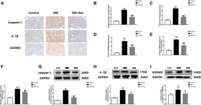 Ranolazine Inhibits Pyroptosis via Regulation of miR-135b in the Treatment of Diabetic Cardiac Fibrosis